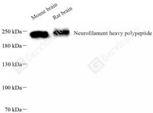 01 GB15141_Neurofilament heavy polypeptide_重组 H395_d1000_WB_WM.png