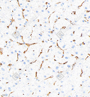 01 GB15340_CD163_M014_d600_H liver_40.0x_IHC_WM.png