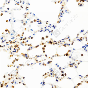 01 GB150006_Myeloperoxidase_ZCRMPO_ZCRMPO231117_d1000_M Inflammatory model induced by lps(24h) lung_40.0x_IHC_WM.png