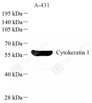 01 GB151017_Cytokeratin 1_重组 H408_d1000_WB_WM.png