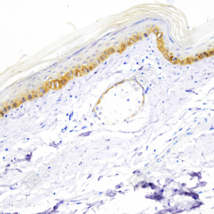 01 GB151247_Cytokeratin 6_ZSR22059_ZSR22059231208_d500_M skin_20.0x_IHC_WM.png