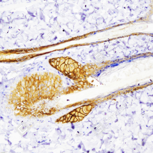 02 GB151247_Cytokeratin 6_ZSR22059_ZSR22059231208_d500_R skin_20.0x_IHC_WM.png