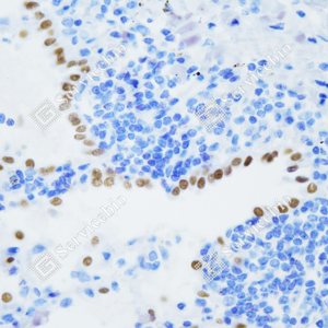 01 GB152168_TTF1(Thyroid transcription factor 1)_ZCM21075_ZCM21075231215_d1000 H lung_40.0x_IHC_WM.png