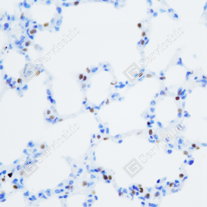 03 GB152168_TTF1(Thyroid transcription factor 1)_ZCM21075_ZCM21075231215_d1000 R lung_40.0x_IHC_WM.png