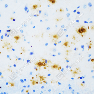 01 GB151197_Amyloid beta 40_ZCM20012_ZCM20012231209_d500 M brain_40.0x_IHC_WM.png