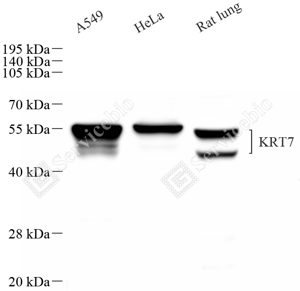 01 GB115695_Cytokeratin 7_C3334_d800_WB_WM.png