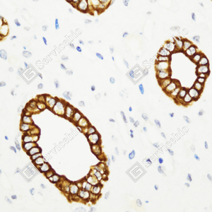 02 GB115695_Cytokeratin 7_C3334_C333423080103_d1500_H kidney_40.0x-IHC_WM.png