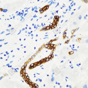 03 GB115695_Cytokeratin 7_C3334_C333423080103_d1500_H liver_40.0x-IHC_WM.png