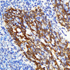 04 GB115695_Cytokeratin 7_C3334_C333423080103_d1500_H tonsil_40.0x-IHC_WM.png