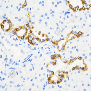 05 GB115695_Cytokeratin 7_C3334_C333423080103_d1500_R kidney_40.0x-IHC_WM.png