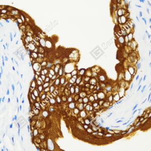 06 GB115695_Cytokeratin 7_C3334_C333423080103_d1500_R urinary bladder_40.0x-IHC_WM.png