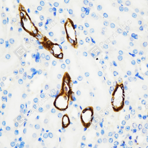 01 GB115696_Cytokeratin 7_C3336_C333623080104_d3000_M kidney_40.0x-IHC_WM.png