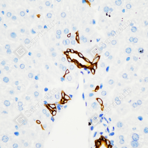 02 GB115696_Cytokeratin 7_C3336_C333623080104_d3000_M liver_40.0x-IHC_WM.png