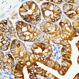 03 GB115696_Cytokeratin 7_C3336_C333623080104_d3000_M small intestine_40.0x-IHC_WM.png