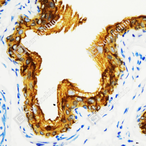 04 GB115696_Cytokeratin 7_C3336_C333623080104_d3000_M urinary bladder_40.0x-IHC_WM.png