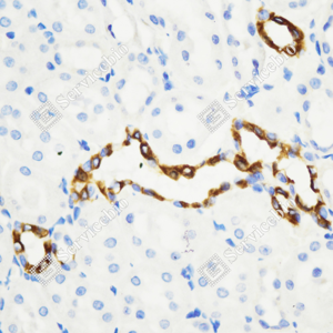 05 GB115696_Cytokeratin 7_C3336_C333623080104_d3000_R kidney_40.0x-IHC_WM.png