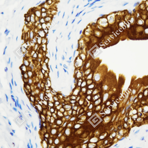 06 GB115696_Cytokeratin 7_C3336_C333623080104_d3000_R urinary bladder_40.0x-IHC_WM.png