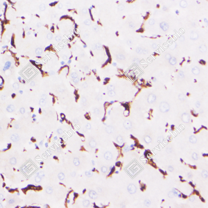 03 GB123502_Iba1-7E10E3_7E10E320240110_d4000_H liver_40.0x_IHC_WM.png