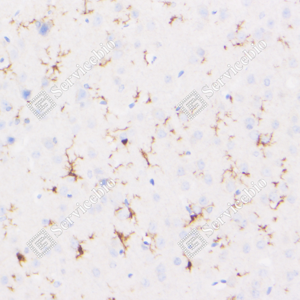 04 GB123502_Iba1-7E10E3_7E10E320240110_d4000_M brain_40.0x_IHC_WM.png