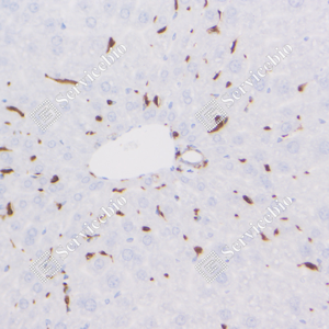 05 GB123502_Iba1-7E10E3_7E10E320240110_d4000_M liver_40.0x_IHC_WM.png