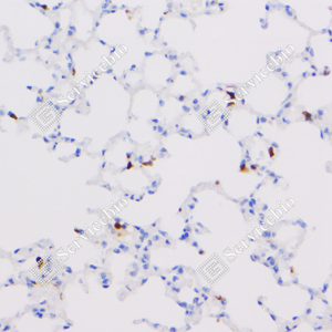 06 GB123502_Iba1-7E10E3_7E10E320240110_d4000_M lung_40.0x_IHC_WM.png