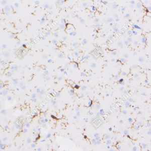 07 GB123502_Iba1-7E10E3_7E10E320240110_d4000_R brain_40.0x_IHC_WM.png