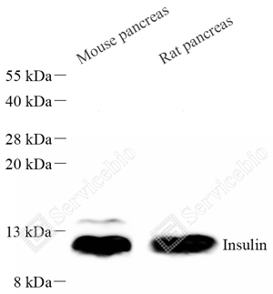 04 GB15334_Insulin_d300_WB_WM.png