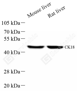 02 GB15232_Cytokeratin 18_A21 ZSM21018240307B_d500_WB_WM.png