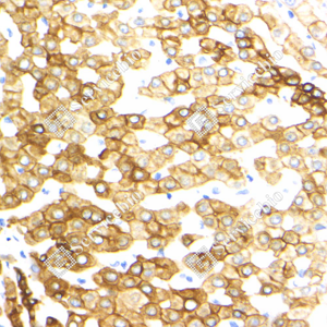 05 GB15232_Cytokeratin 18_ZSM21018240307B_d500_H liver_40.0x_IHC_WM.png