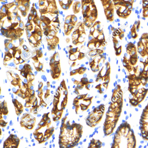 07 GB15232_Cytokeratin 18_ZSM21018240307B__d500_H stomach_40.0x_IHC_WM.png