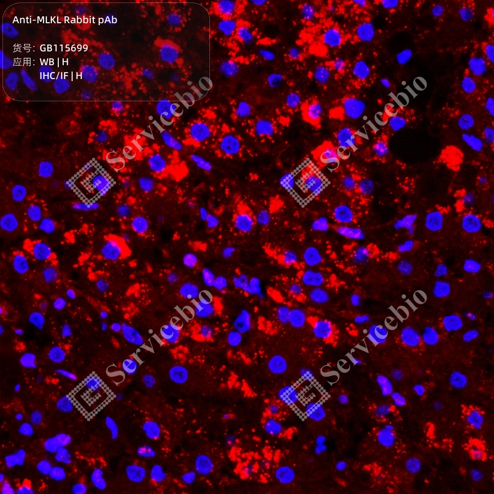 MLKL (P18) Rabbit mAb main image 0