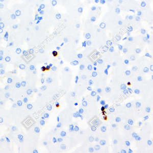 03 GB120004_MMP9_2-6D8_d300_H liver_40.0x_IHC_WM.png