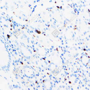 07 GB120004_MMP9_2-6D8_d300_H stomach_40.0x_IHC.png