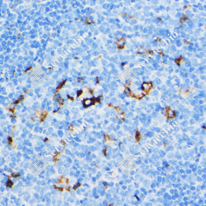 08 GB120004_MMP9_2-6D8_d300_H tonsil_40.0x_IHC.png