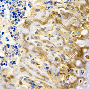 01 GB150010_Collagen II_ZCR17011240223_ZCR17011_d500_M cartilage_40.0x_IHC_WM.png