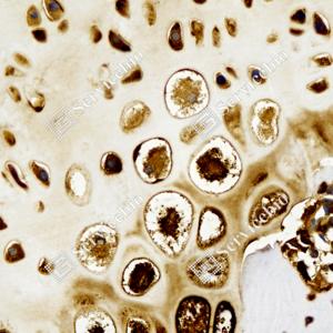 02 GB150010_Collagen II_ZCR17011240223_ZCR17011_d500_R cartilage_40.0x_IHC_WM.png