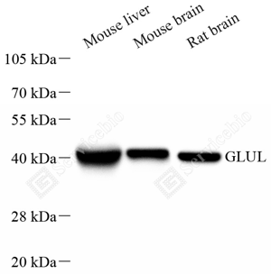 01 GB151177_Glutamine Synthetase_A27 ZCM2003240223_d1000_WB_WM.png