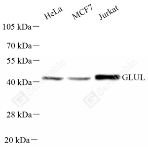 02 GB151177_Glutamine Synthetase_A27 ZCM2003240223_d1000_WB_WM.png