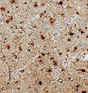 03 GB151177_Glutamine Synthetase_ZCM20003240223_ZCM20003_d5000_H brain_20.0x_IHC_WM.png