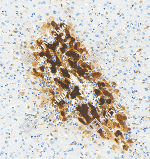 05 GB151177_Glutamine Synthetase_ZCM20003240223_ZCM20003_d5000_H liver_20.0x_IHC_WM.png