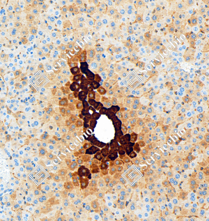 06 GB151177_Glutamine Synthetase_ZCM20003240223_ZCM20003_d5000_M Inflammation of the liver_20.0x_IHC_WM.png