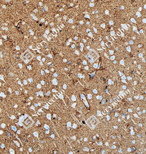 07 GB151177_Glutamine Synthetase_ZCM20003240223_ZCM20003_d5000_R brain_20.0x_IHC_WM.png