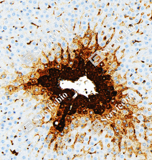 08 GB151177_Glutamine Synthetase_ZCM20003240223_ZCM20003_d5000_R liver_20.0x_IHC_WM.png