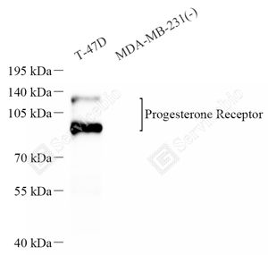 01 20240415_Progesterone Receptor _d1000_WB(1).png