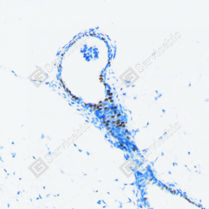 04 20240423_YM7202_progesterone receptor d200 R breast_20x_IHC.png