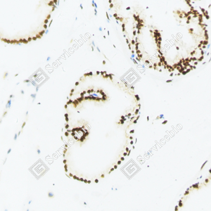 01 20240423_YM7012_androgen receptor_ d200 mouse prostate_20x_IHC.png