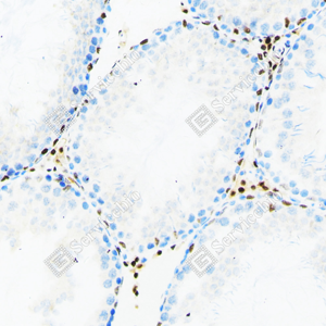 03 20240423_YM7012_androgen receptor_ d200 rat testis_20x_IHC.png