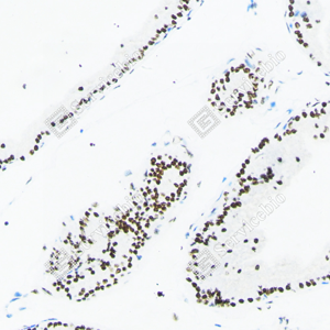 04 20240423_YM7012_androgen receptor_d200 rat prostate_20x_IHC.png