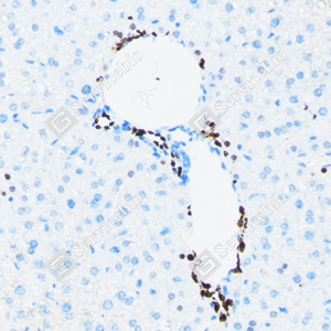 03 20240423_YM7213_sox-9 d200 M liver_20_IHC.png