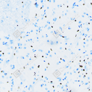 04 20240423_YM7213_sox-9 d200 M spinal cord _20_IHC.png